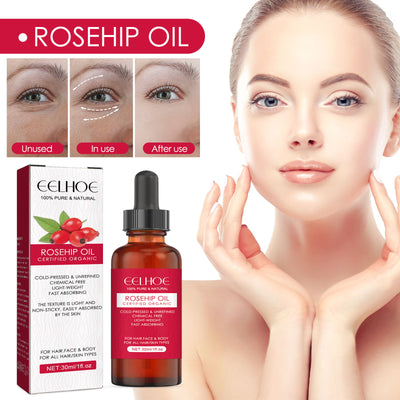 EELHOE Rosehip Facial Oil for Facial and Body Hydration, Nourishing Skin Care, Smooth Hair Care, and Massage Oil