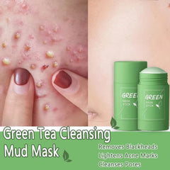 Original Facial Remove Blackhead Green Tea Solid Mask Treat Acne Blemish Black Dots Clean Stick Cream Shrink Pores Skin Care